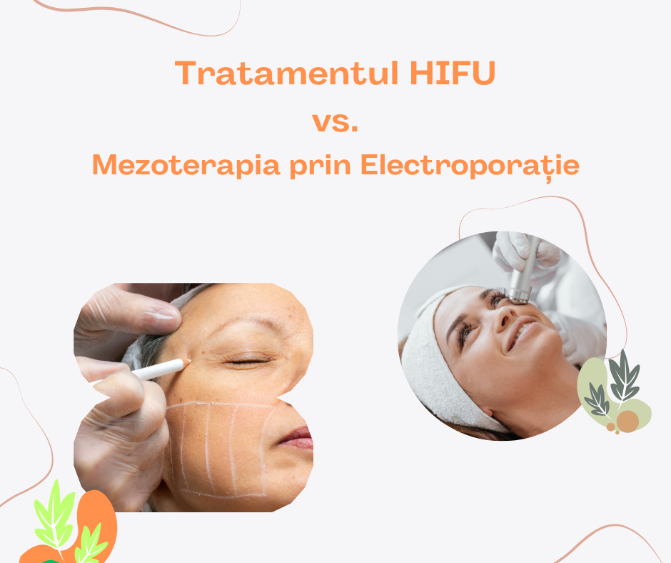 Tratamente HIFU vs Mezoterapie
